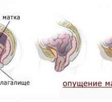Omiterea uterului