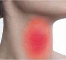 Principalele metode de tratament al cancerului tiroidian hipotiroidism la femei