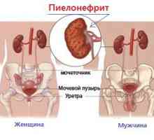 Pielonefrită Concepte renale