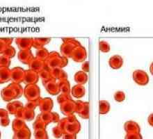 Principalele cauze ale anemiei