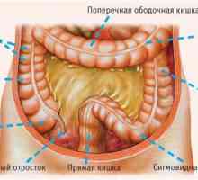 Principalele motive pentru și metodele de tratare a dolichocolon intestinului