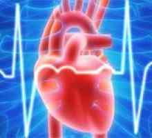 Principalele cauze ale aritmii cardiace