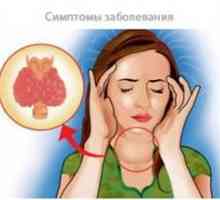 Principalele simptome ale bolii tiroidiene la femei și tratamentul lor