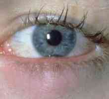 Caracteristici de tratament a fierbe la ochi