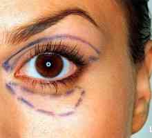 Caracteristici transconjunctivala ochi blefaroplastie