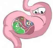 Gastrita de reflux acută sau karma produselor alimentare greșită