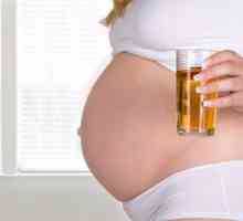 Din care există urinare frecventă în timpul sarcinii? Simptomele acestei probleme.
