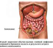 Cauze și simptome de peritonită acută