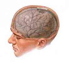 Edem cerebral: cauze și forme, simptome, tratament, complicații și prognostic