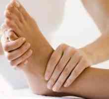 Umflarea picioarelor - Cauze, Tratament