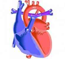 Deschideți arterială canalului arterial (PAC): cauze despicătură la copii, simptome, cum să trateze