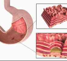 Ulcer peptic