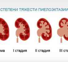 Dreapta pyelectasia rinichi și rinichi stâng