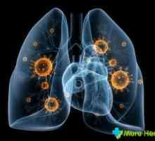 Simptome pneumonie fără febră: cum să recunoască boala în timp util