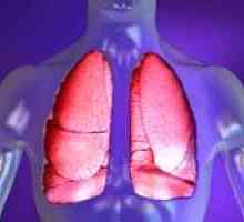 Pneumonie (inflamație pulmonară). Tratamentul de remedii populare.