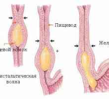 Simptomele și tratamentul bolilor ale esofagului