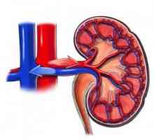 Hipertensiune renala: cauze, simptome, examen, terapia