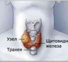 De ce sunt site-uri de pe glanda tiroidă și hormoni în timp ce în intervalul normal
