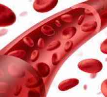 De ce a izbucnit vasele de sânge în organism, și ce să facă