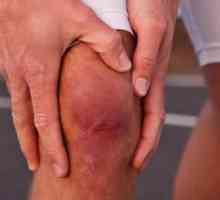 De ce este umflat si dureri de genunchi