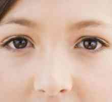 Care sunt cauzele umflarea ochilor și cum să scape de ele repede