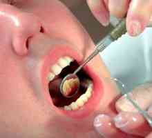 Am urcat de-a lungul gingiilor dinte: cum să-l vindeca?
