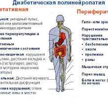 Polineuropatia: membrului inferior diabetic, alcool (toxic) și altele