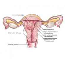 Polipii și endometrioza: ceea ce este plină de această combinație?