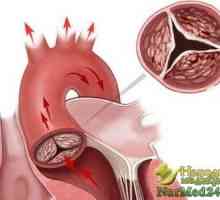 Ajuta remedii populare în tratamentul stenoza aortica la copii si adulti