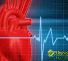 Ajuta remedii populare în tratamentul inimii Artim