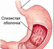 Gastro de suprafață - simptome și tratament