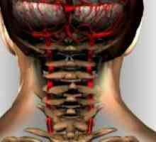 Artera vertebral și patologia