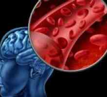 Medicamente care imbunatatesc fluxul de sange la creier