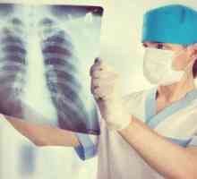 Cauzele și tratamentul edem pulmonar interstițial