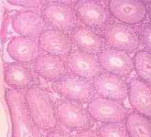 Cauzele monocitele sanguine crescute