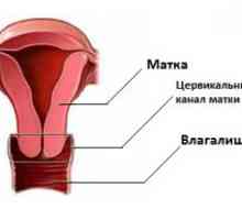 Cauzele dilatare de col uterin la femeile aflate la menopauza