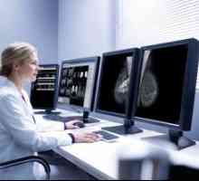 Motivele pentru dezvoltarea și tratamentul fibrozei al sânului