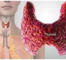 Cauze, simptome si tratamentul euthyrosis tiroidian
