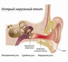 Cauzele simptomelor si tratamentul otitei urechii medii