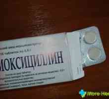 Amoxicilină și recenzii despre ea