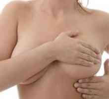 Mastodinon Aplicarea în timpul menopauzei