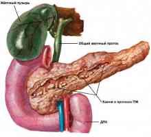 Care sunt simptomele de pancreatita sunt exprimate la barbati?
