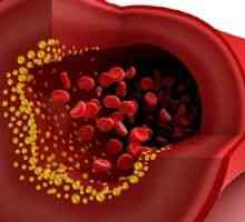 Ce chol în analiza biochimică a sângelui