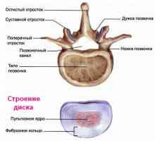 Proeminența de disc vertebral și consecințele sale