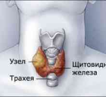 Site-ul puncție tiroidiană