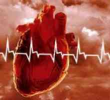 Resuscitarea stop cardiac - ce trebuie să știe și să poată să