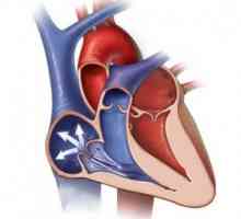 Valve cardiace regurgitarea: simptome, masura, diagnostic, tratament