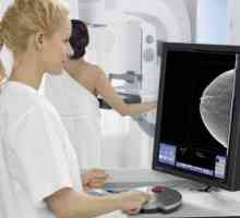 Screening mamar cu raze X: mamografie