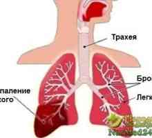 Riscul de pneumonie la adulți și copii