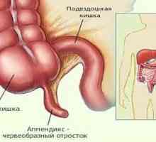 Posibile cauze de inflamație a apendicelui